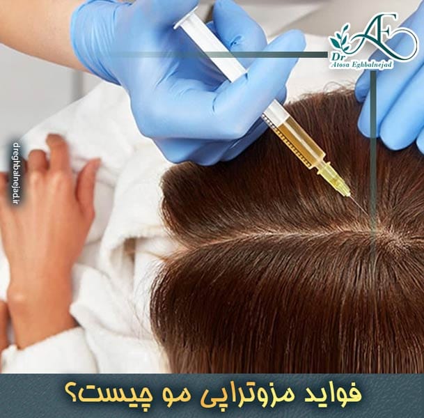 فواید مزوتراپی مو + نحوه انجام مزوتراپی مو