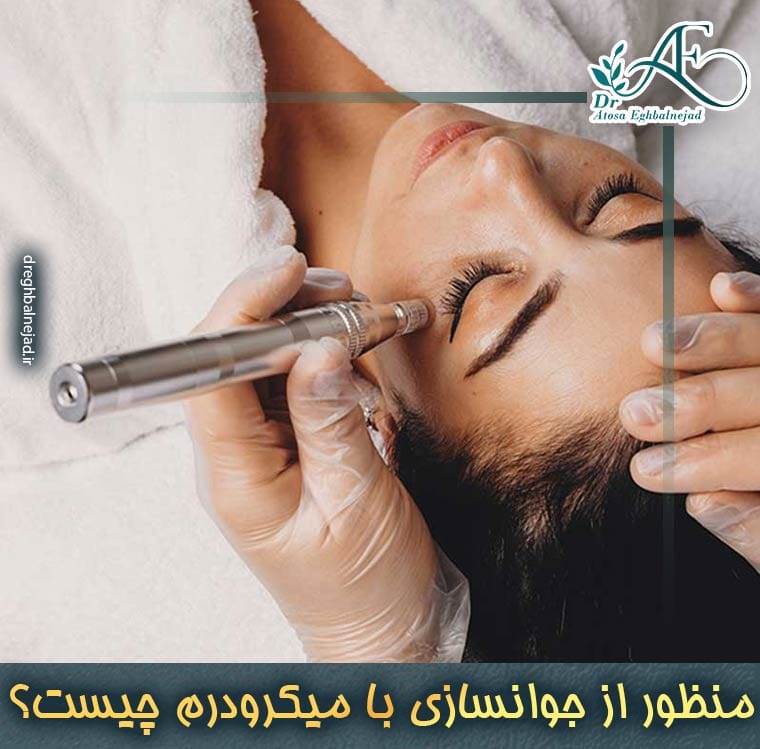 میکرودرم