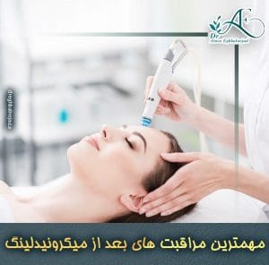 مهمترین مراقبت های بعد از میکرونیدلینگ