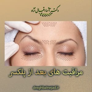 مراقبت های بعد از پلکسر https://dreghbalnejad.ir/