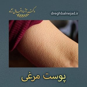 پوست مرغی https://dreghbalnejad.ir/