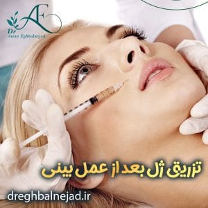 تزریق ژل بعد از عمل بینی https://dreghbalnejad.ir/
