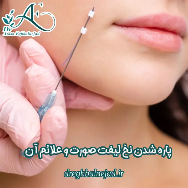 پاره شدن نخ لیفت صورت